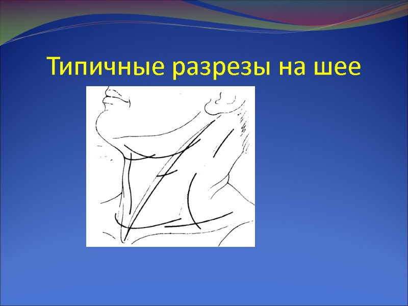 Типичные разрезы на шее